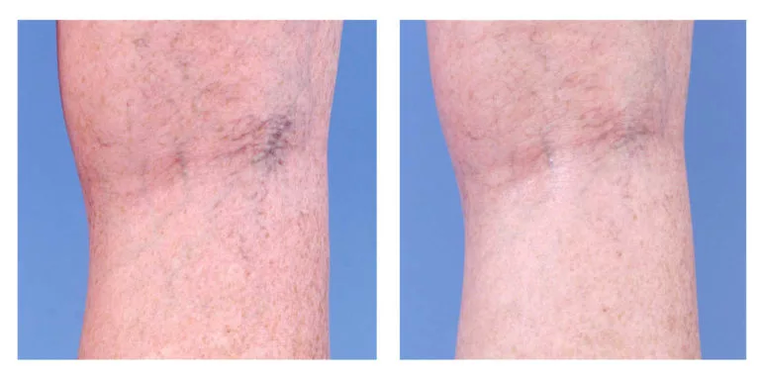 Kosmeetiline korrektsioon